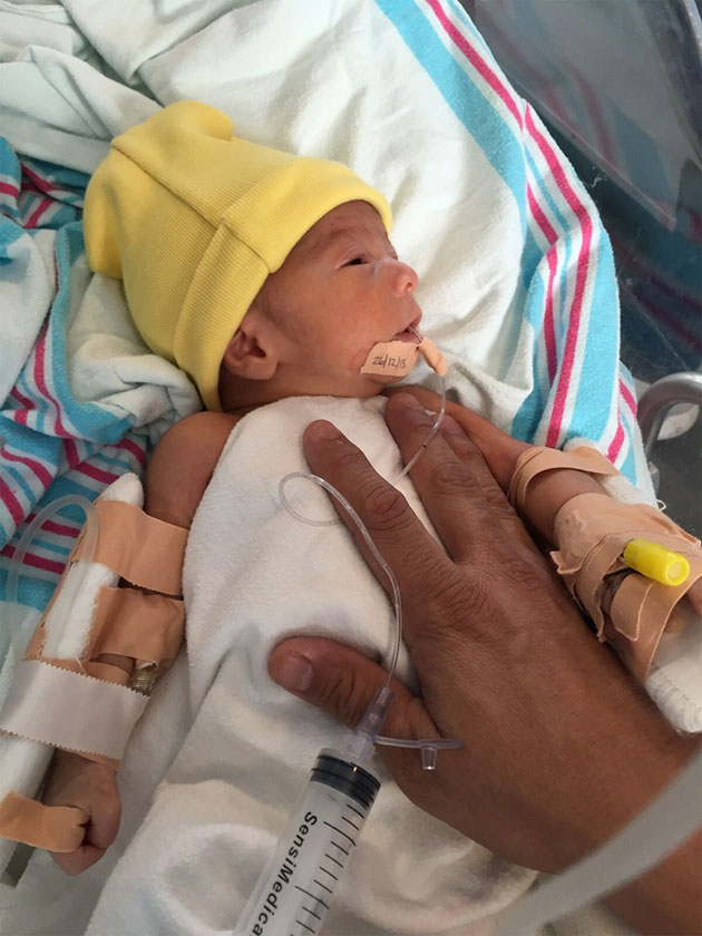 A Christmas Miracle for Baby Shamir Born with Incomplete Esophagus A Christmas Miracle for Baby Shamir Born with Incomplete Esophagus