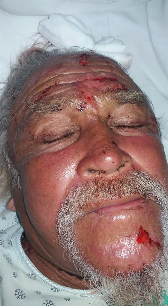 Two Stabbed and Chopped at Caye Caulker