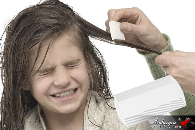 Strange Home Remedies to Remove Head Lice!