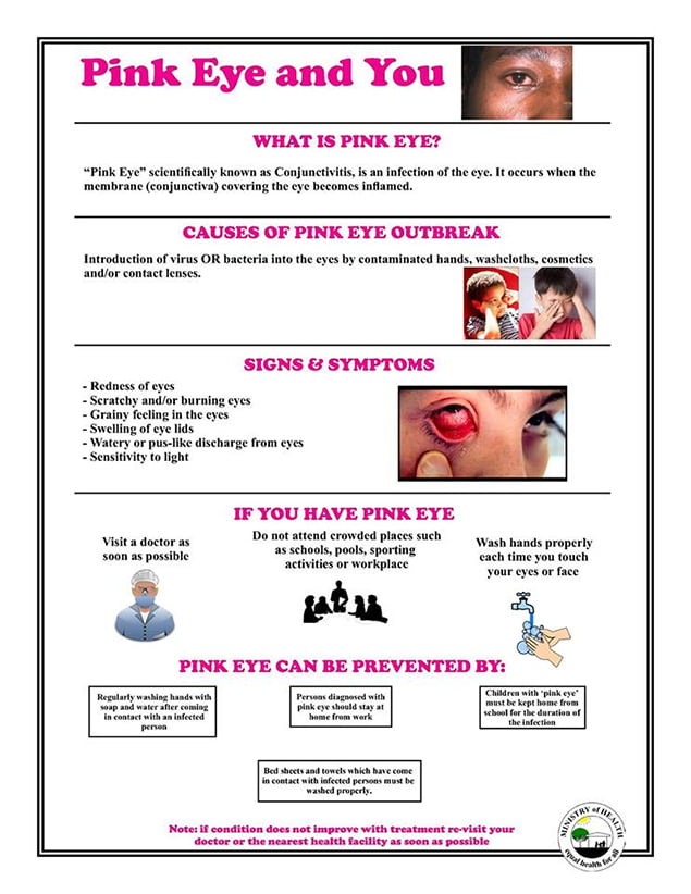 HEALTH ADVISORY - Increase in “Pink Eye” cases in Neighboring Quintana Roo 1 HEALTH ADVISORY - Increase in “Pink Eye” cases in Neighboring Quintana Roo