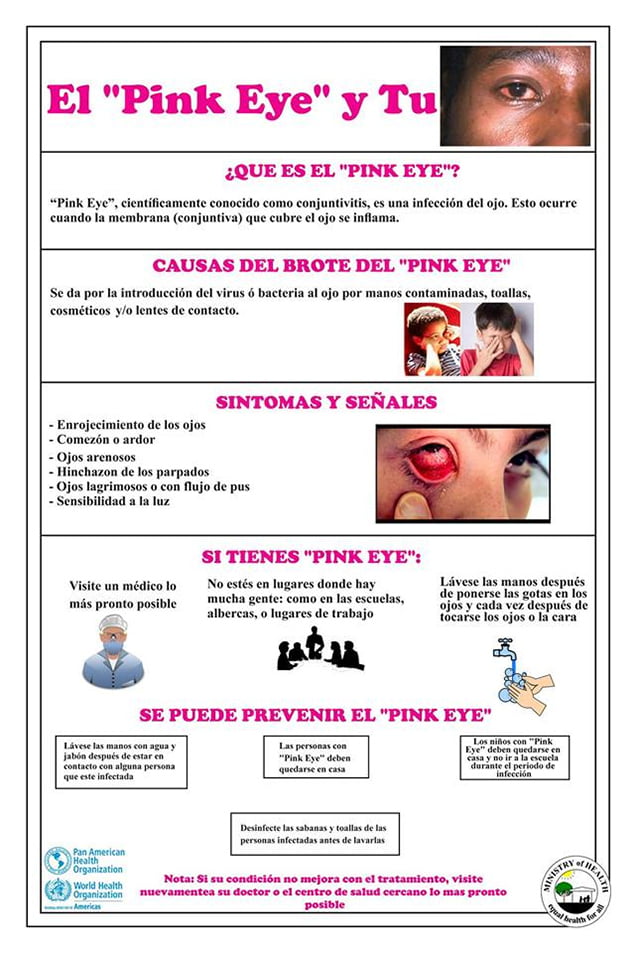 HEALTH ADVISORY - Increase in “Pink Eye” cases in Neighboring Quintana Roo 2 HEALTH ADVISORY - Increase in “Pink Eye” cases in Neighboring Quintana Roo