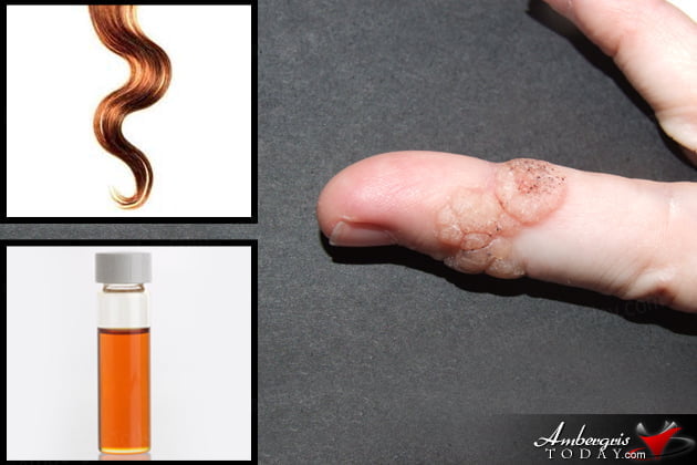 Strange Belize Home Remedies for Portuguese Man of War, Warts and Hiccups