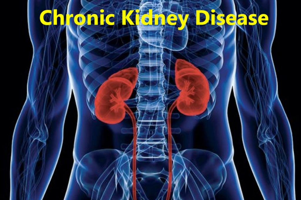 Belize Among Countries with Highest Prevalence of Chronic Kidney Disease 24
