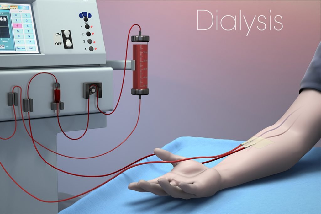 Government of Belize to Expand Hemodialysis Program 3