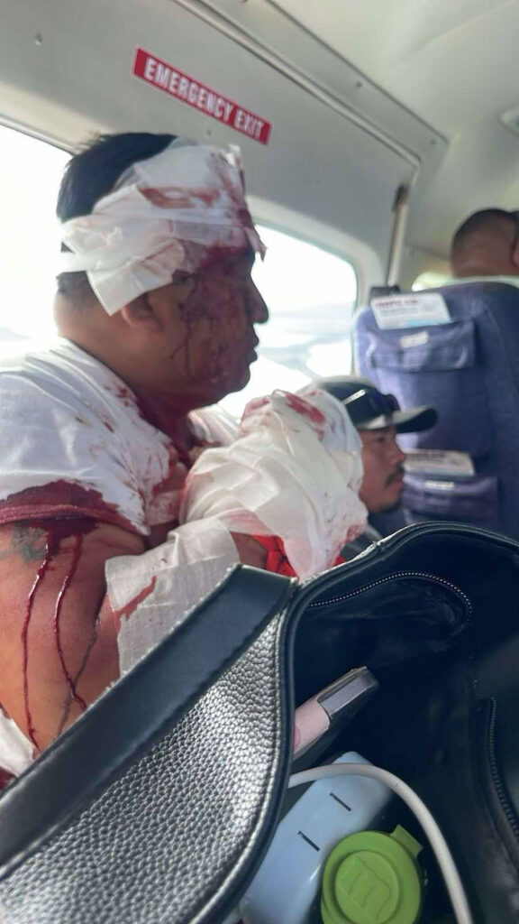 tropic air plane hijacking belize